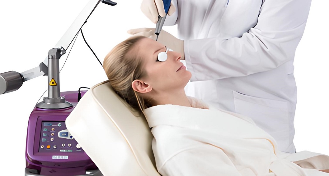 Action II Fractional Laser Treatment