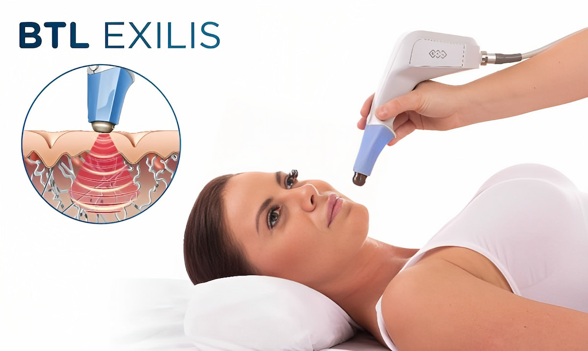 BTL Exilis Face and Body Sculpting