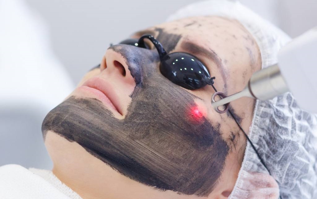 Carbon Laser Peel - Spectra XT