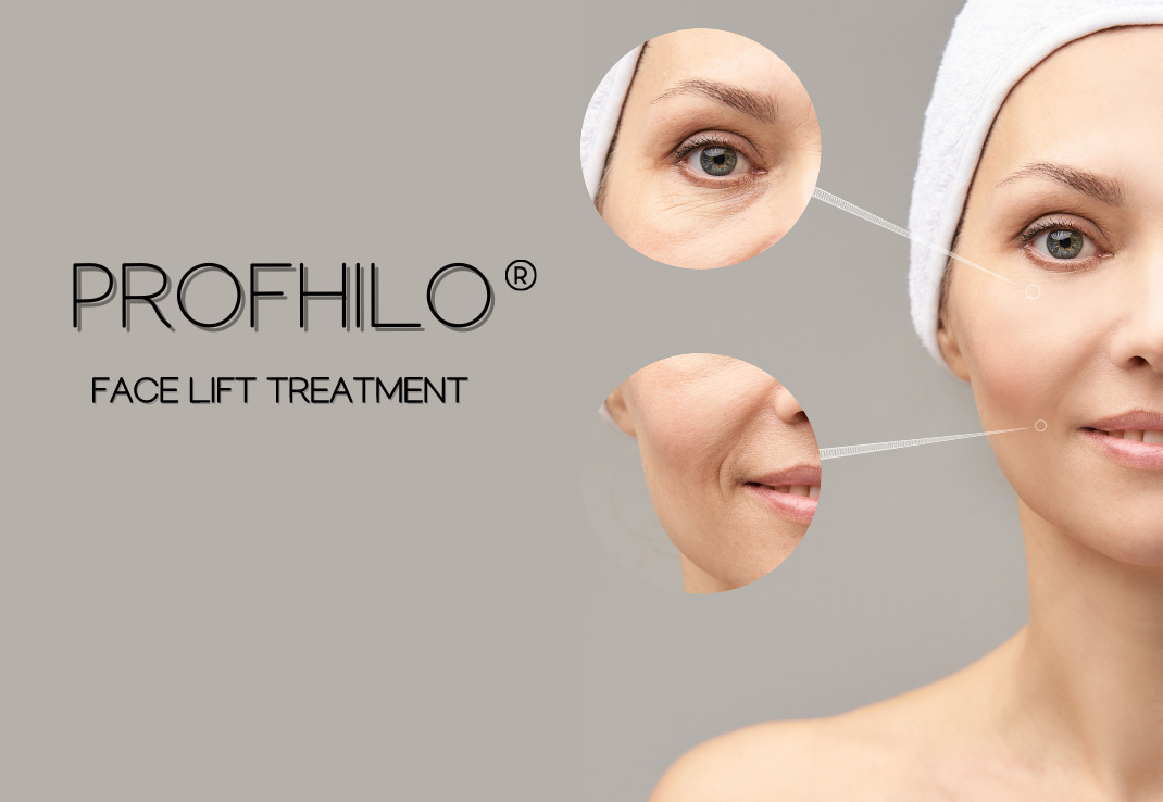 Profhilo Injection for Face & Body